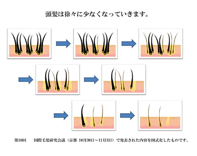 《6本セット》アドバンジェン・レキシリス.ブラックスカルプローション6本セット【医薬部外品】【薬用育毛剤】【LEXILIS. BLACK】