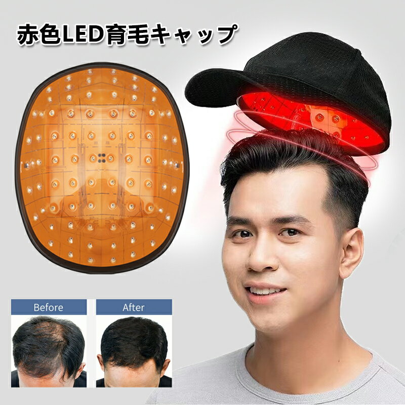 育毛キャップ 育毛システム81個 赤色 led 育毛 赤外線led 育毛デバイス 育毛 ヘルメット 薄毛・抜け毛対策 髪 薄毛脱毛治療 発毛促進 発毛 養毛 薄毛 増毛 発毛器 脱毛症 薄毛治療 レーザー治療装置 赤色光 FDA認証済み