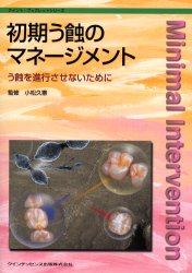 初期う蝕のマネージメント　う蝕を進行させないために