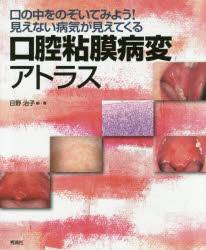 口腔粘膜病変アトラス 口の中をのぞいてみよう！見えない病気が見えてくる