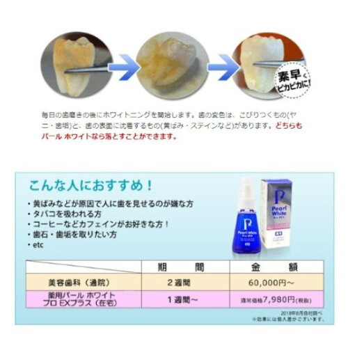 薬用パールホワイトプロexプラスpearl White その他 Proex 30ml 2本セット Treasure Marketご家庭で簡単に歯のホワイトニング 薬用パールホワイトプロexプラスpearl White その他 Proex 30ml 2本セット Treasure Marketご家庭で簡単に歯のホワイトニング