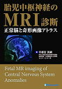 【中古】 胎児中枢神経のMRI診断 正常脳と奇形画像アトラス(3)