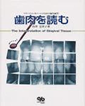 【中古】 歯肉を読む プラークコントロールのための歯肉観察