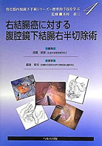 【中古】 右結腸癌に対する腹腔鏡下結腸右半切除術 (消化器内視鏡下手術シリーズ 標準的手技を学ぶ)
