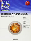 【中古】 網膜剥離 こうすれば治る?復位率100%をめざして (新ES Now 4)