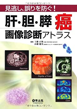 【中古】 肝・胆・膵癌画像診断アトラス 見逃し、誤りを防ぐ!