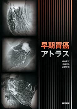 乐天商城 - 【中古】 早期胃癌アトラス