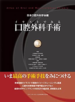 Other - 【中古】 イラストでみる口腔外科手術 第1巻