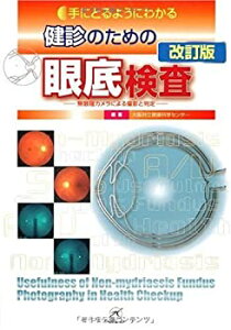 【中古】 健診のための眼底検査 改訂版?無散瞳カメラによる撮影と判定? (手にとるようにわかる)