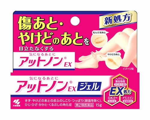 【第2類医薬品】小林製薬　アットノンEXジェル　(15g)　アットノン　ジェル