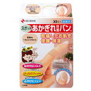 ニチバン あかぎれ保護バン スポット用 (30枚) 指用 絆創膏