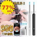 \SALE限定77%OFF+P5倍!/【即納】耳かき カメラ イヤースコープ 耳掃除 ライト 耳掻き ピンセットカメラ付き 耳そうじ 子供 みみかき 照明 介護耳かき 大人 赤ちゃん ペット お年寄りこども 接続簡単 人気 おすすめ