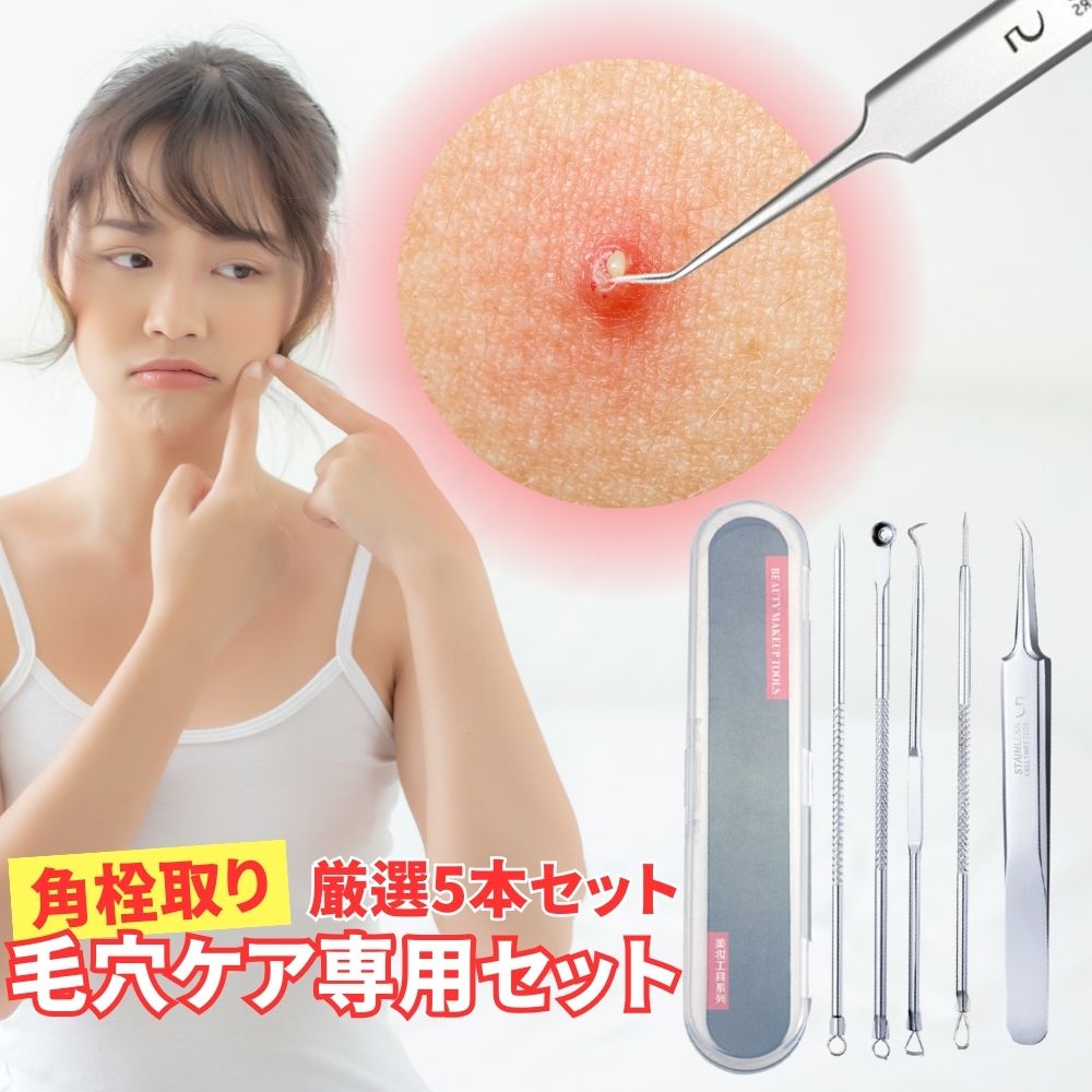 コメドプッシャー 毛穴ケア 毛穴 毛穴ケア専用キット ピーリング ニキビ跡 クレーター 胸 クレーター 背中 黒 ニキビ 取り 方 改善 潰し 道具 潰す 針 器具 芯 出し 角栓取りピンセット 毛抜き 角栓 スティック 角栓除去 メンズ 極細 毛穴 押し出し器具 プッシャー コメド