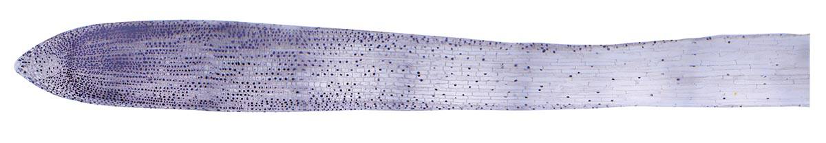 長い根の 細胞分裂 プレパラート タマネギロング