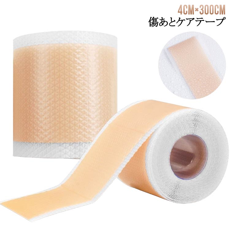 帝王切開 ケア 傷 帝王切開 傷跡 帝王切開 傷 テープ 帝王切開 テープ テープ 刺青隠し 4cm×300cm 傷あとケアテープ タトゥー 隠す シール タトゥー 隠し タトゥー シールのサムネイル