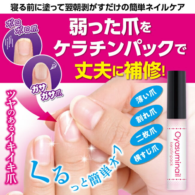 �����䤹�ߥͥ��륱�����ѥå�[�ͥ��륱�� ���� �ѥå� �ݼ� �������󥰥��� �� �ͥ��� ���ƥѥå� ������� ����Ѥ��� �ͥ��륰�å� ���� �к� ���� �ɤä� �Ϥ��� �ͥ���ѥå� �ޥѥå� ������]