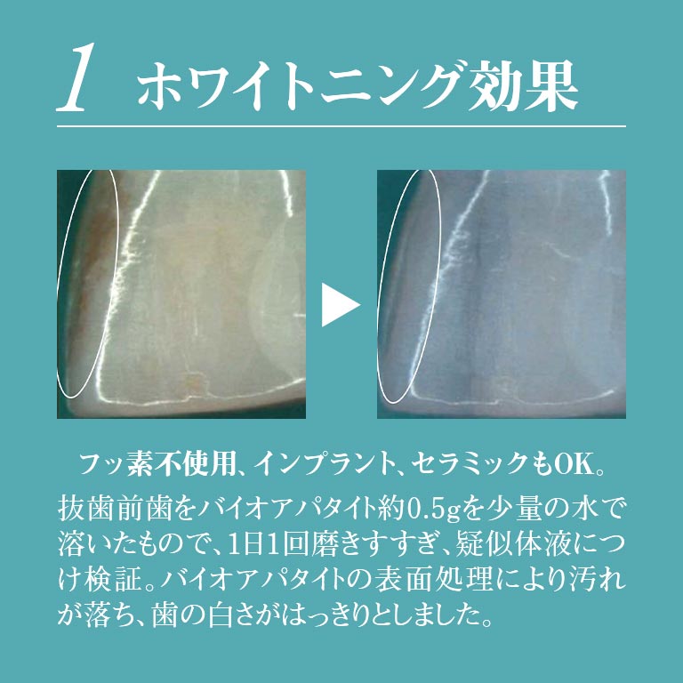 レ—ヴ ナチュラル トゥースジェル 80g ホワイトニング歯磨き粉 ナチュラル 歯を白くする 歯ぐきケア 天然由来 成分 無添加 日本製 フッ素フリー 電動歯ブラシ対応 セラミック対応 インプラント対応 歯周病予防 ヤニ取り ステイン除去 口臭ケア 低刺激 3