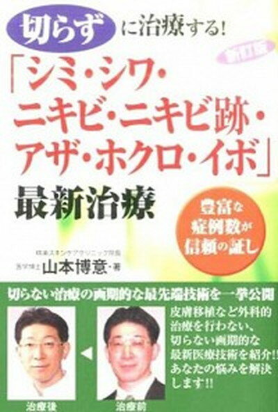 【中古】切らずに治療する！「シミ シワ ニキビ ニキビ跡 アザ ホクロ イボ」最新治療 豊富な症例数が信頼の証し 新訂版/白誠書房/山本博意（単行本）