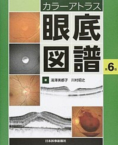 【中古】カラ-アトラス眼底図譜 第6版/日本医事新報社/湯沢美都子（大型本）