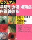 【中古】ビジュアル早期胃・食道・咽頭癌内視鏡診断 写真とイラストでわかる内視鏡手技と診断のコツ/学研メディカル秀潤社/門馬久美子(大型本)