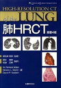 【中古】肺HRCT/丸善出版/W.リチャ-ド・ウェブ(大型本)