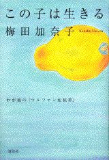 【中古】この子は生きる わが娘の「マルファン症候群」/講談社/梅田加奈子（単行本）
