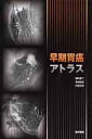 【中古】早期胃癌アトラス /医学書院/細井董三(大型本)