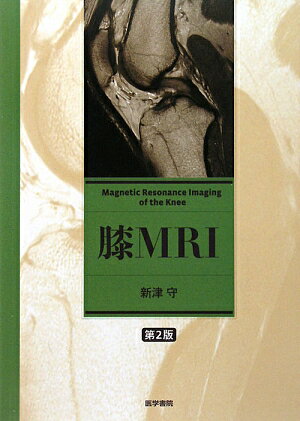 【中古】膝MRI 第2版/医学書院/新津守（単行本）