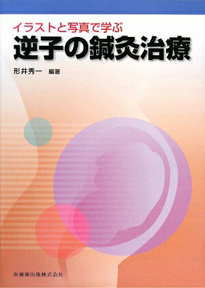 【中古】イラストと写真で学ぶ逆子の鍼灸治療 増補/医歯薬出版/形井秀一（1951-）（単行本（ソフトカバー））