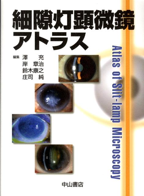 【中古】細隙灯顕微鏡アトラス/中山書店/沢充（単行本）