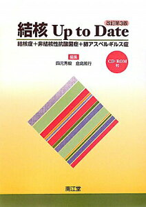 【中古】結核Up to Date 結核症+非結核性抗酸菌症+肺アスペルギルス症 改訂第3版/南江堂/四元秀毅(単行本)