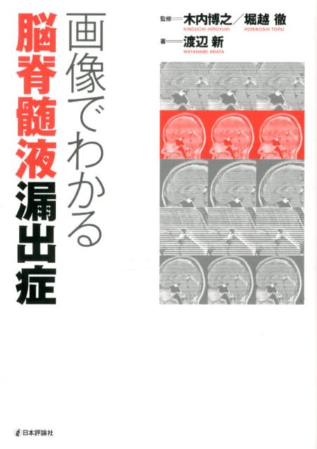◆◆◆非常にきれいな状態です。中古商品のため使用感等ある場合がございますが、品質には十分注意して発送いたします。 【毎日発送】 商品状態 著者名 渡辺新、木内博之 出版社名 日本評論社 発売日 2012年07月 ISBN 978453598...