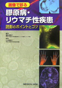 【中古】画像で診る膠原病・リウマチ性疾患 読影のポイントとコツ /メジカルビュ-社/山田隆之(単行本)