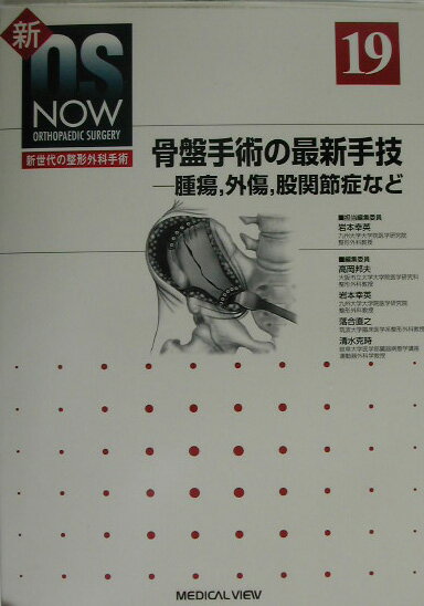 広範骨欠損の再建手術 (新OS NOW-新世代の整形外科手術) 宗昭，