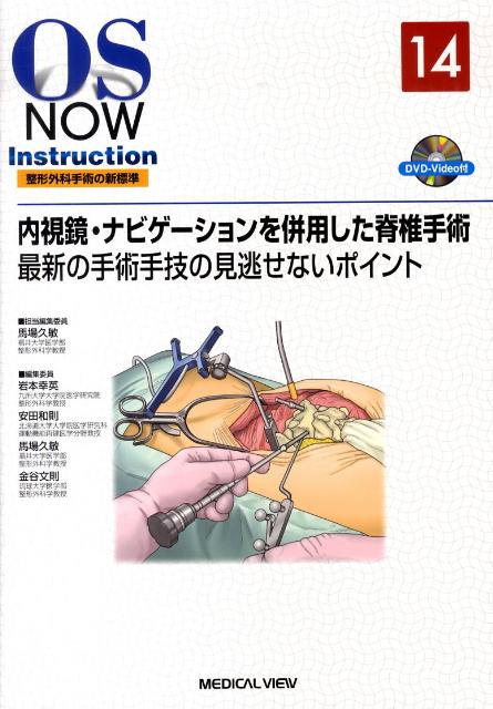 楽天市場】mist手技における側方経路椎体間固定術(lif)入門の通販