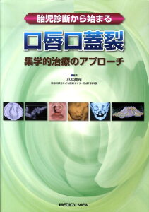 【中古】胎児診断から始まる口唇口蓋裂 集学的治療のアプロ-チ/メジカルビュ-社/小林眞司(単行本)