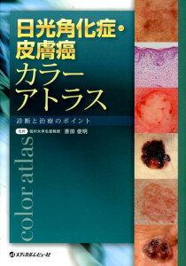 【中古】日光角化症・皮膚癌カラ-アトラス 診断と治療のポイント /メディカルレビュ-社/斎田俊明(大型本)