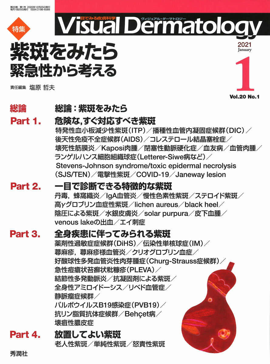 ◆◆◆非常にきれいな状態です。中古商品のため使用感等ある場合がございますが、品質には十分注意して発送いたします。 【毎日発送】 商品状態 著者名 ヴィジュアルダーマトロジー編集委員会 出版社名 学研メディカル秀潤社 発売日 2020年12月25日 ISBN 9784780907360
