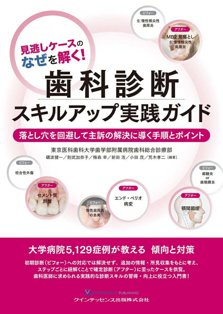 【中古】見逃しケースのなぜを解く！歯科診断スキルアップ実践ガイド 落とし穴を回避して主訴の解決に..