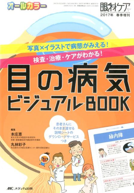 【中古】眼科ケア 17年春季増刊 オールカラー目の病気ビジュアルBOOK /メディカ出版/本庄恵（単行本）