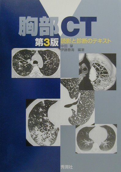 楽天市場】研修医のための実践ガイド 胸部ct 腫瘤性病変の通販