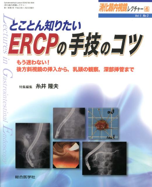 【中古】消化器内視鏡レクチャ- l-3 /総合医学社（大型本）