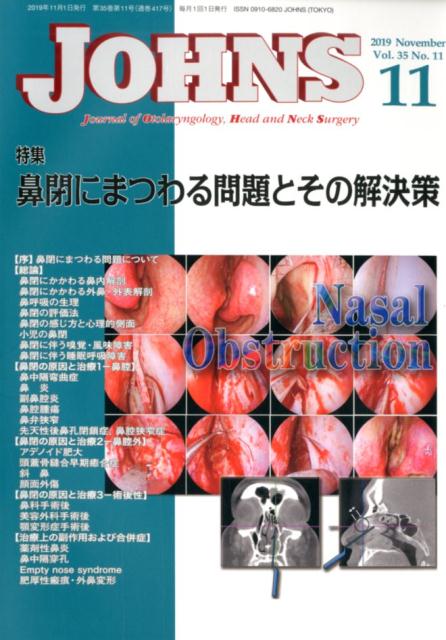 【中古】JOHNS Vol．35　No．11（20/東京医学社（単行本）