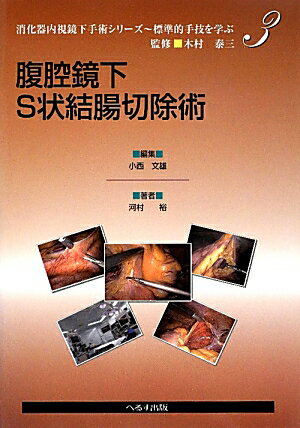 【中古】腹腔鏡下S状結腸切除術 /へるす出版/小西文雄（単行本）