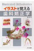 【中古】イラストで覚える歯科矯正学/松本歯科大学出版会/栗原三郎（単行本）