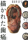 【中古】描かれた歯痛 白と黒、および神経からなる歯科医療挿画 /河出書房新社/リチャード・バーネット(単行本)