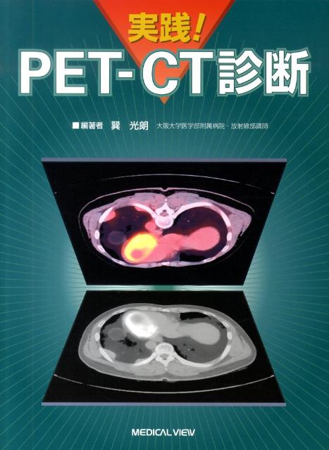 【中古】実践！ PET-CT診断 /メジカルビュ-社/巽光朗（単行本）