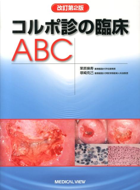 【中古】コルポ診の臨床ABC 改訂第2版/メジカルビュ-社/栗原操寿（単行本）
