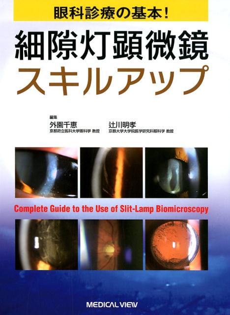楽天市場】細隙灯顕微鏡自由自在の通販