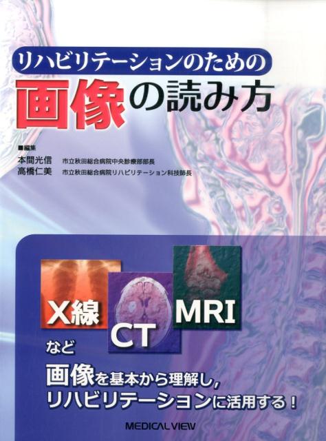 【中古】リハビリテ-ションのための画像の読み方 /メジカルビュ-社/本間光信（単行本）